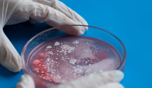 Kulturen in einer Petrischale